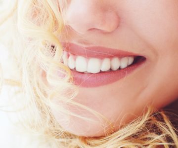 Schöne weisse Zähne mit Bleaching Zahnaufhellung im Zahnzentrum an der Fluke Bremen Vegesack