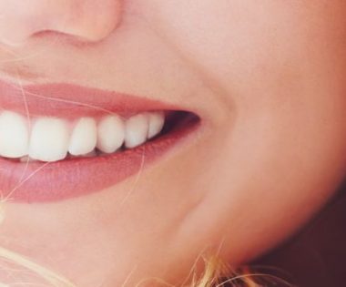 Smile-Makeover mit Veneers aus Keramik im Zahnzentrum Fluke in Bremen