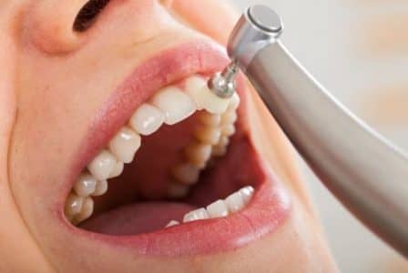 Professionelle Zahnreinigung Zahnpolitur bei Ihrem Prophylaxe Zahnarzt Bremen Nord