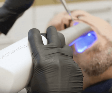 Digitaler Zahnabdruck ohne Würgereiz mit dem Intraoralscanner